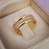 Double Ring with Embedded Zirconias